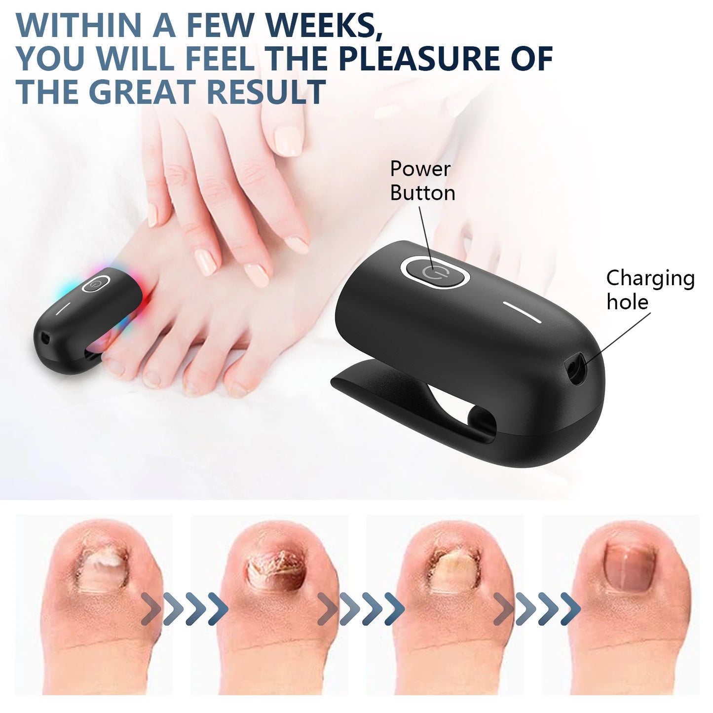 KTS Nail Fungus Laser Device Toenail Laser Therapy Machine